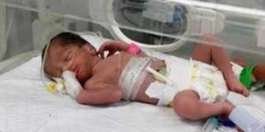 استخراج طفلة من رحم فلسطينية استشهدت بغارة إسرائيلية على منزل فى رفح