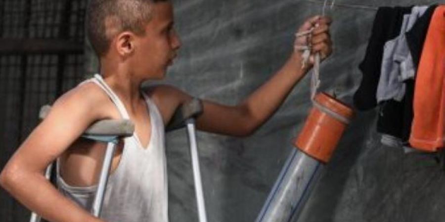 طفل فلسطينى يستعين بـ"ماسورة" لتعويض قدمه المبتورة بسبب القصف الإسرائيلى